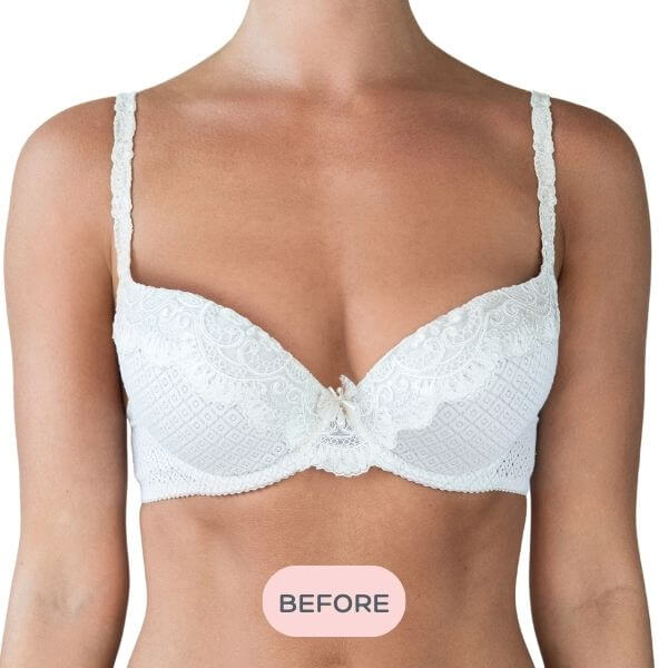 Before - Uneven Breasts Bra Filler
