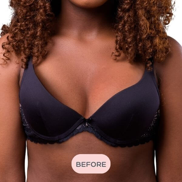 Bra Balancer™ - Difference of 1-2 Cup Sizes - Before