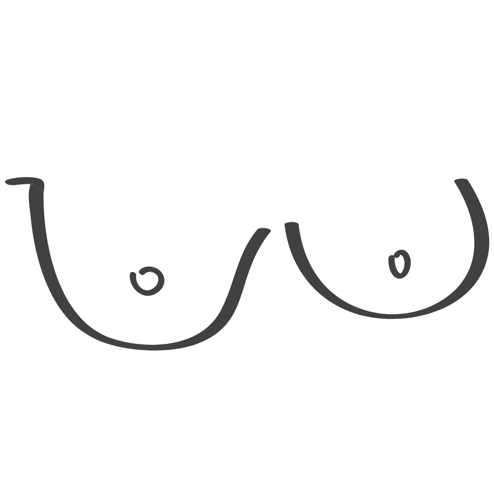 Breast Asymmetry in Puberty Illustration