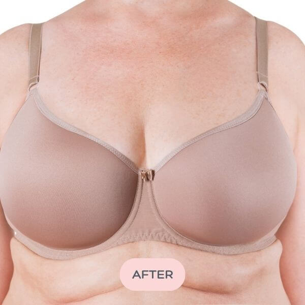 Bra Balancer™ - Difference of 2-3 Cup Sizes - After